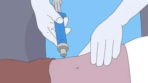 华西医院腹壁整形术多少钱？机构简介、医院口碑及价格表先后查看！